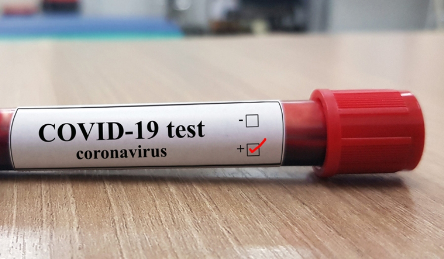 नेपालमा कोरोना संक्रमितको संख्या १ सय ९ पुग्यो, थप ७ जनामा संक्रमण पुष्टि